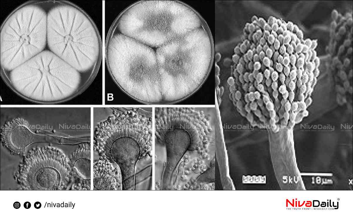 Aspergillus lentulus fungal