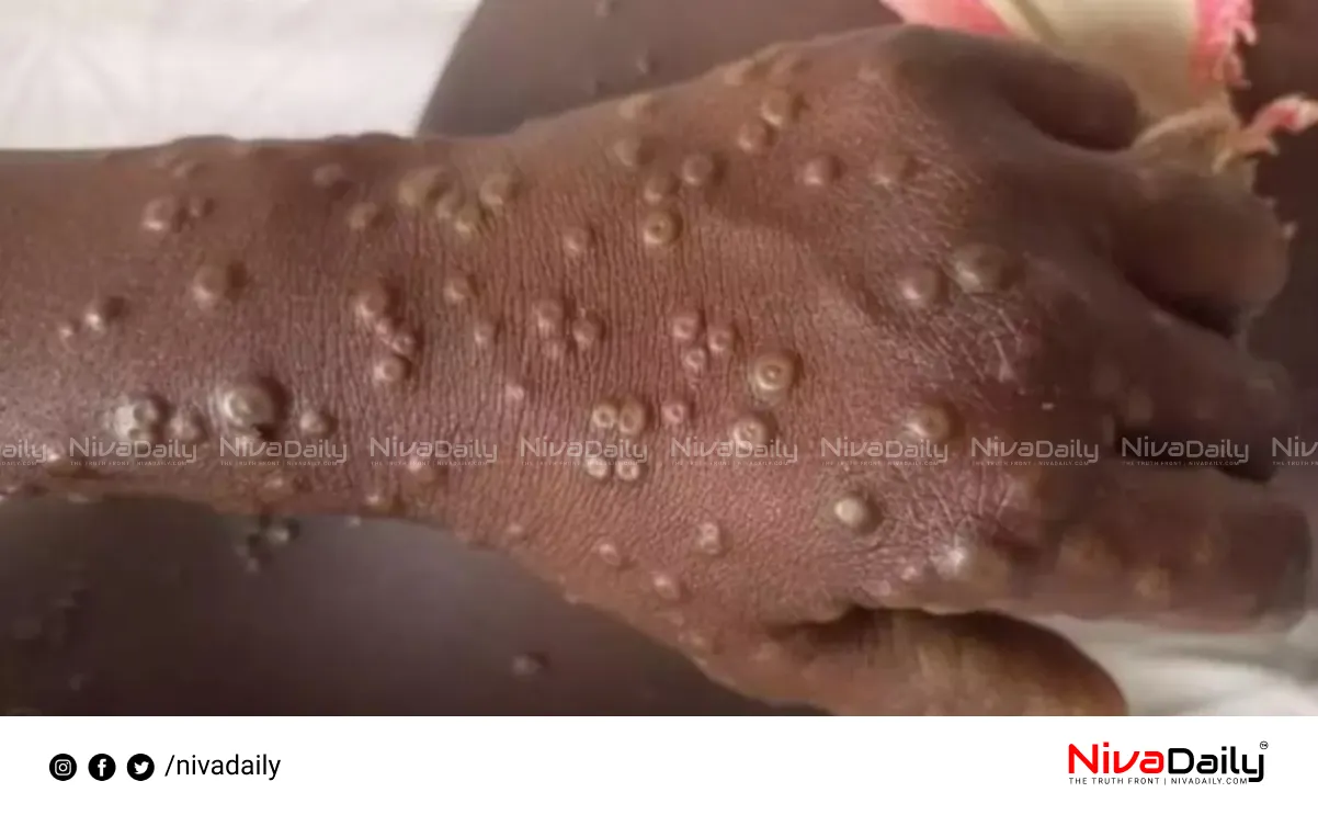 Mpox case India