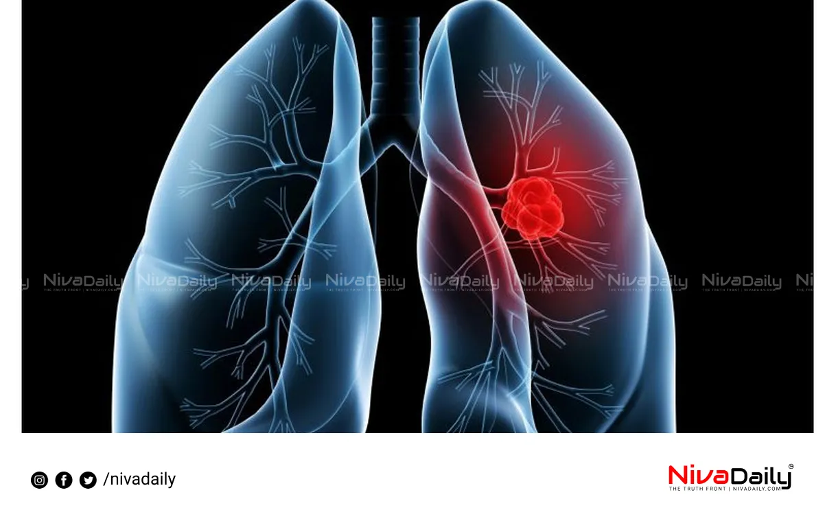 lung cancer early detection