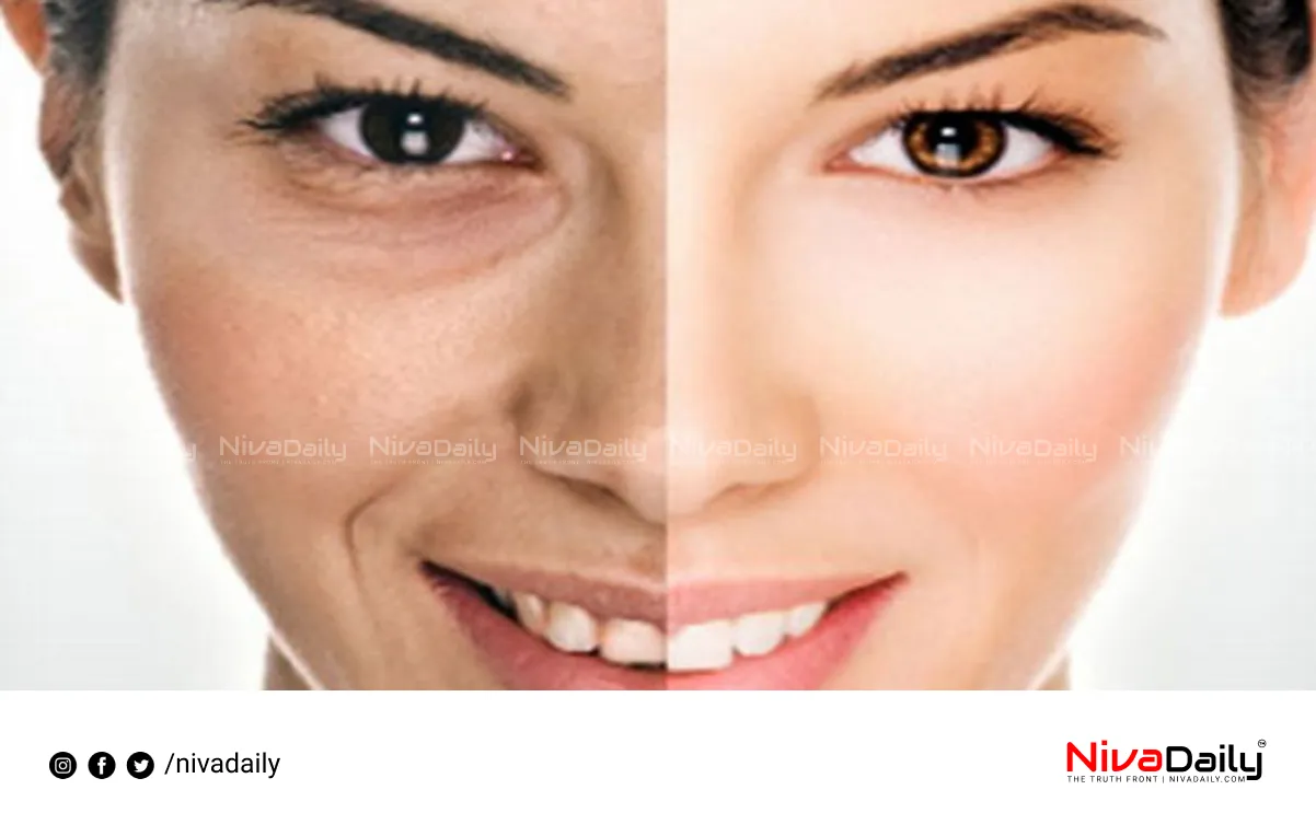 Skin Discoloration