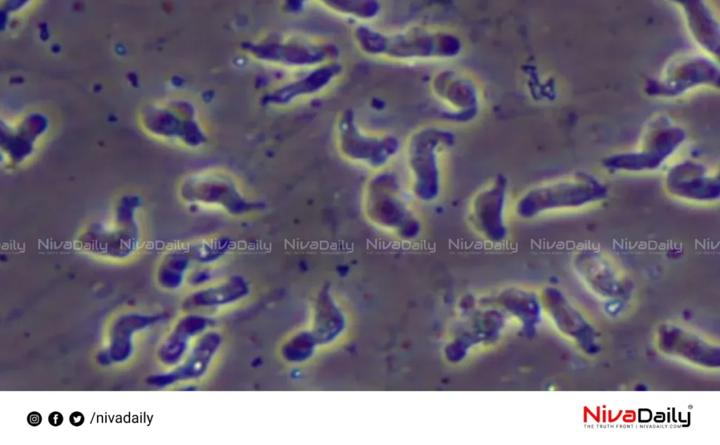 Amoebic Encephalitis