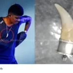 leopard tooth