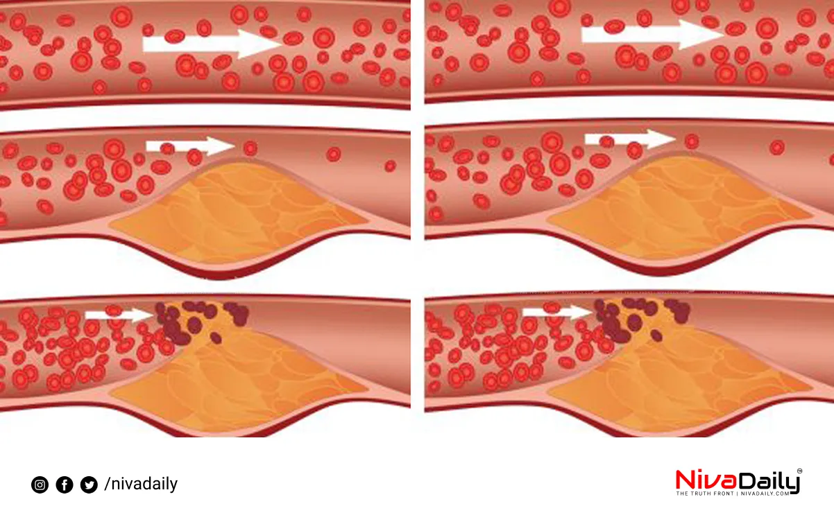 reduce cholesterol