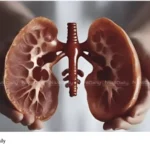 kidney health tips