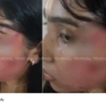 Lawyer Assault