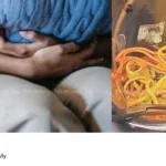 rubber bands stomach