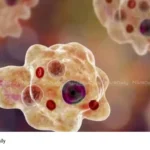 Amoebic Meningoencephalitis Kerala