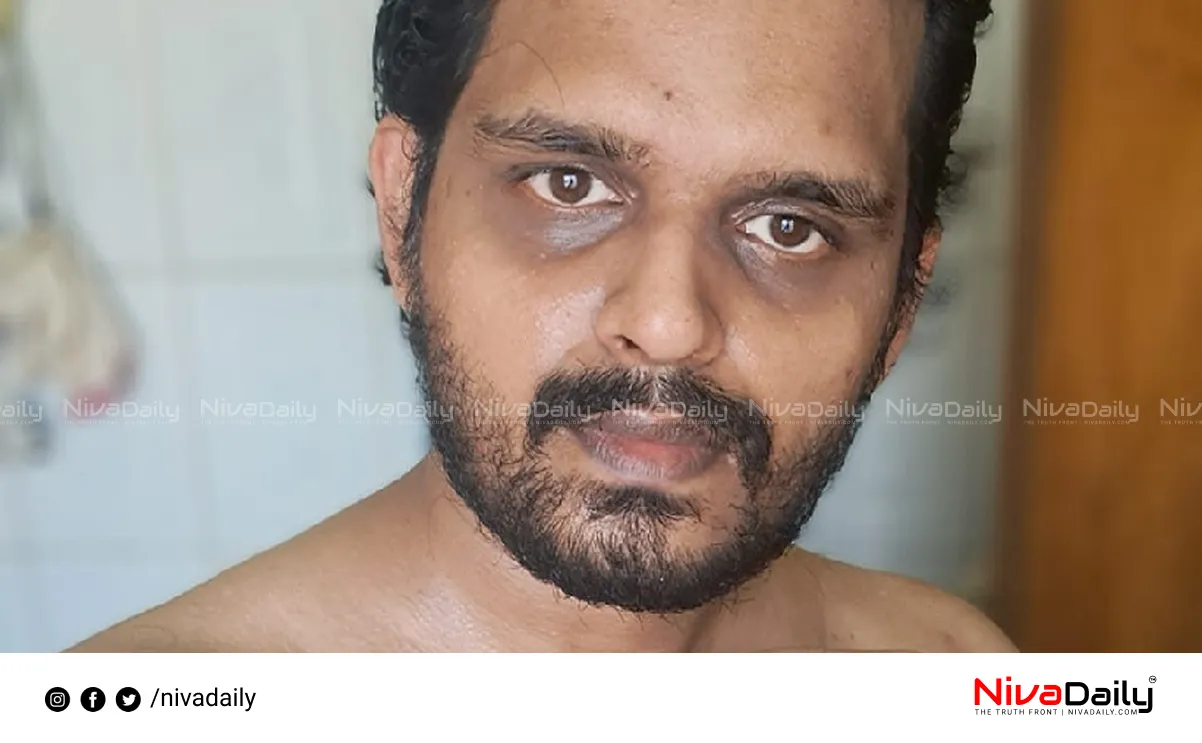 police attack case