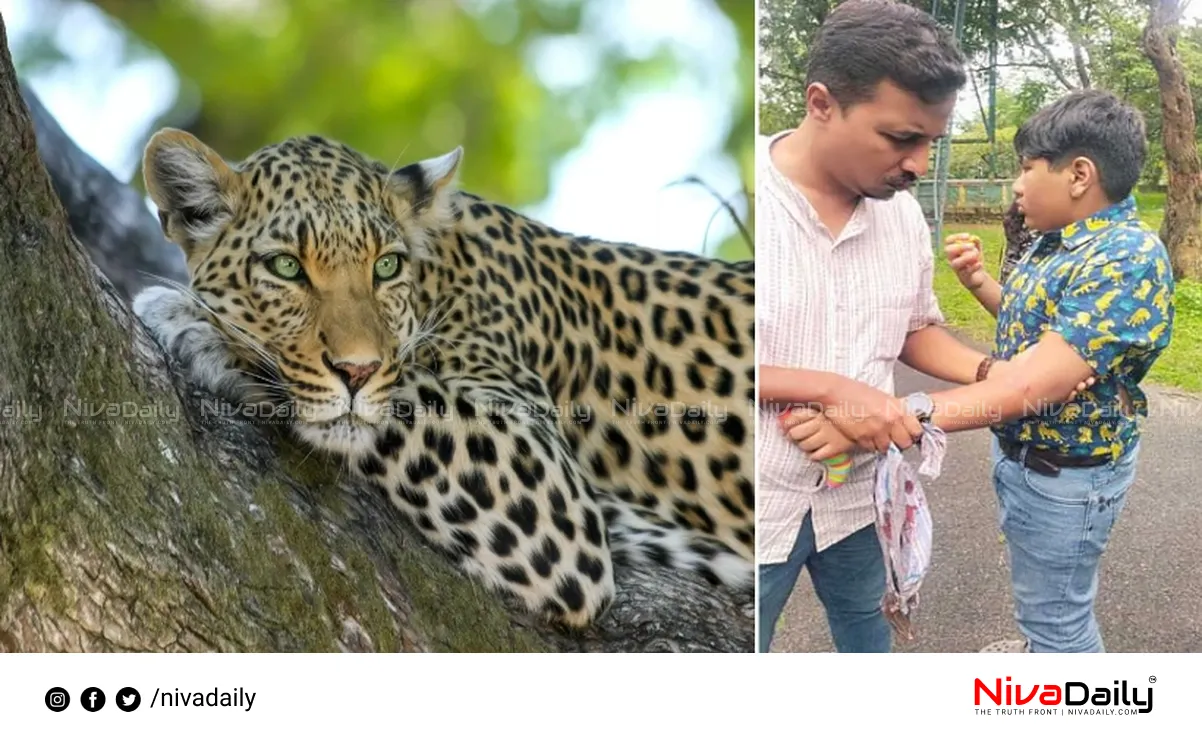 Leopard attack