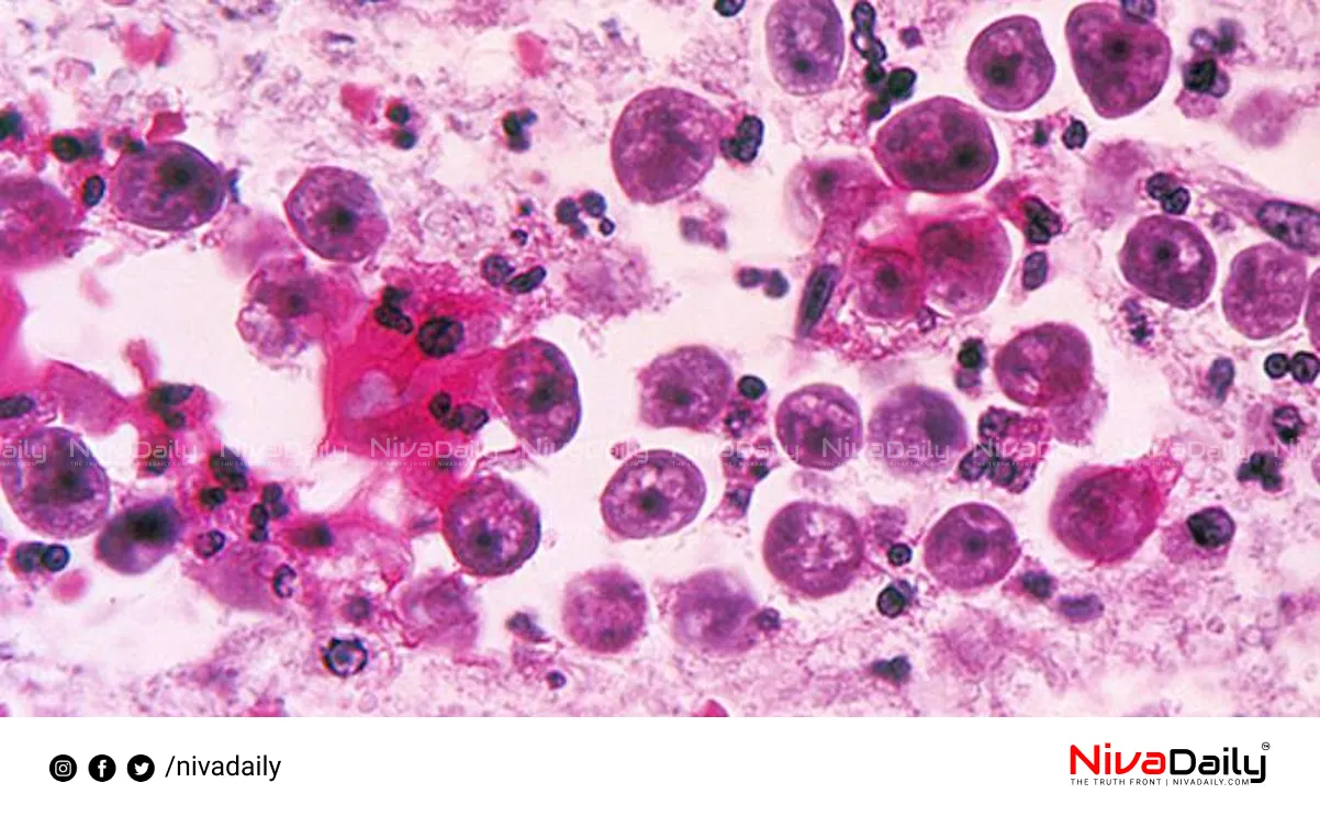 Amoebic Encephalitis Kerala