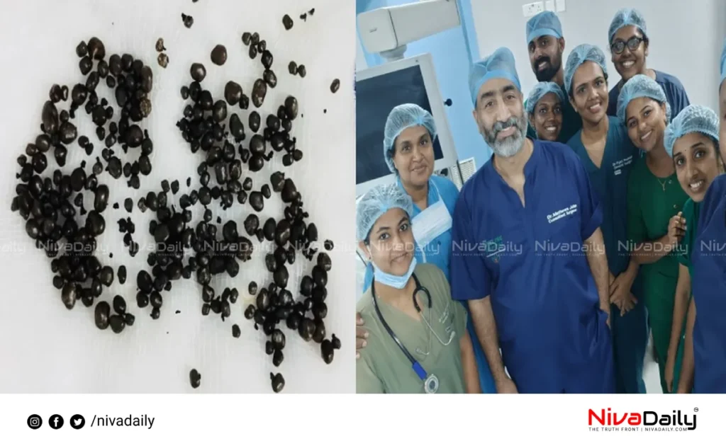 gallbladder stones removal