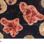 Amebic Encephalitis Kerala