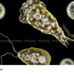 Amebic Meningitis Kerala