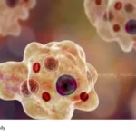 Amebic Meningitis Kerala
