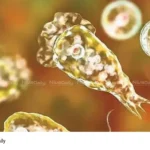 Amoebic Encephalitis