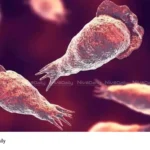 Amebic Meningoencephalitis death