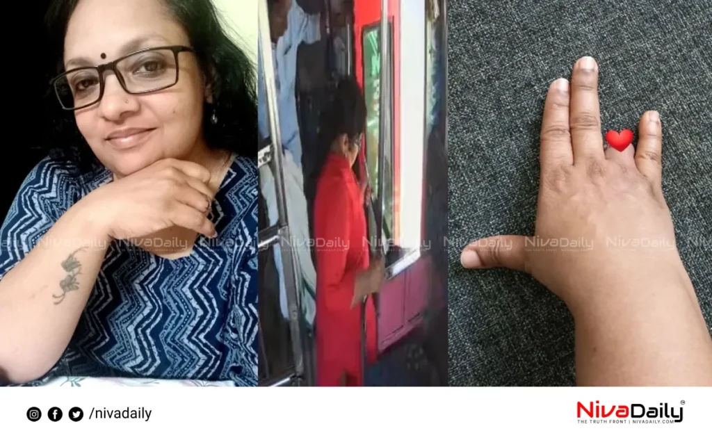 bus accident finger loss