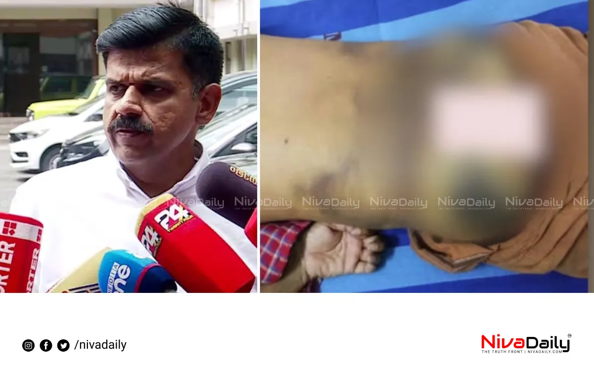 Kerala police brutality