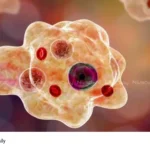 amebic meningoencephalitis