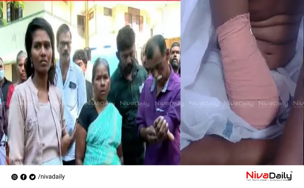 Hand Amputation Surgery