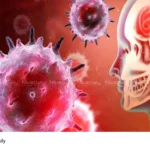 Amebic Encephalitis Kerala