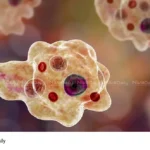 Amoebic Meningoencephalitis