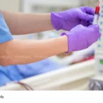 Dialysis Technician Recruitment