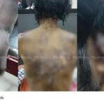 Worker torture case