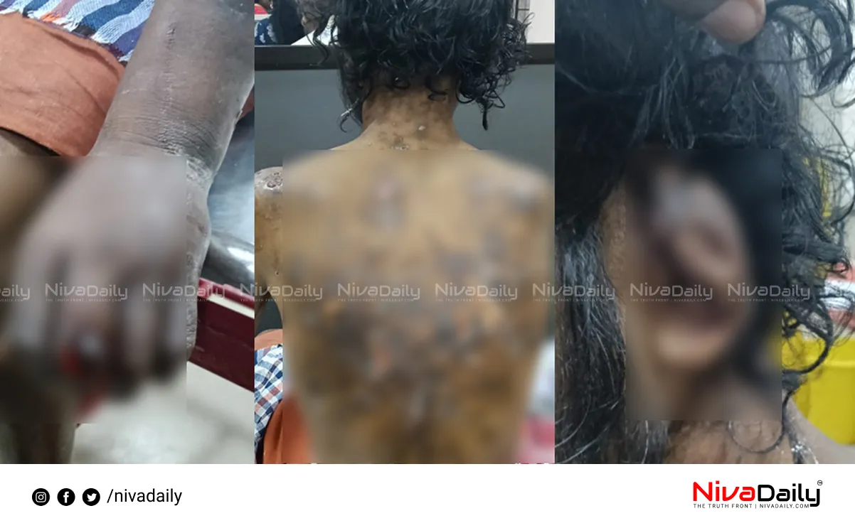 Worker torture case