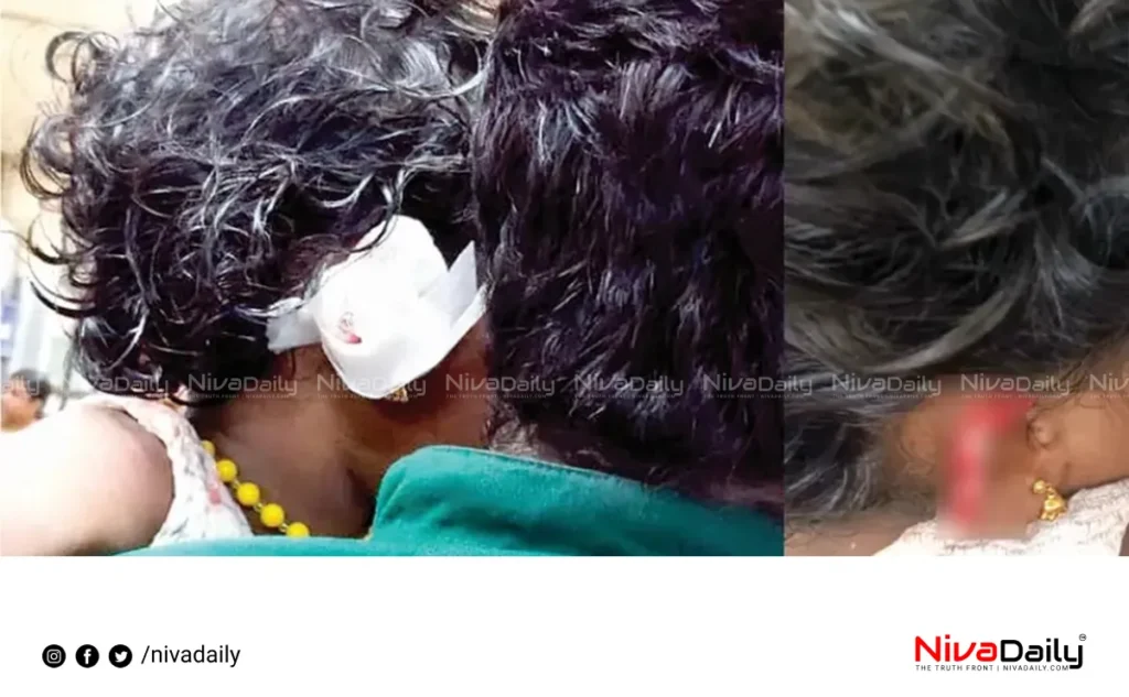stray dog attack