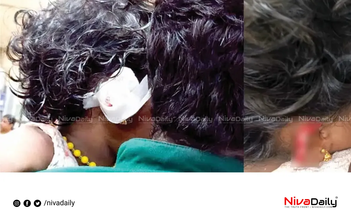 stray dog attack