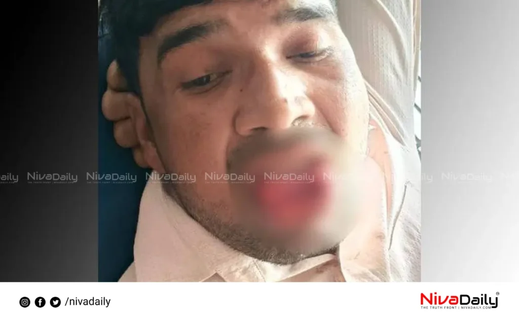 Kanpur tongue bite incident