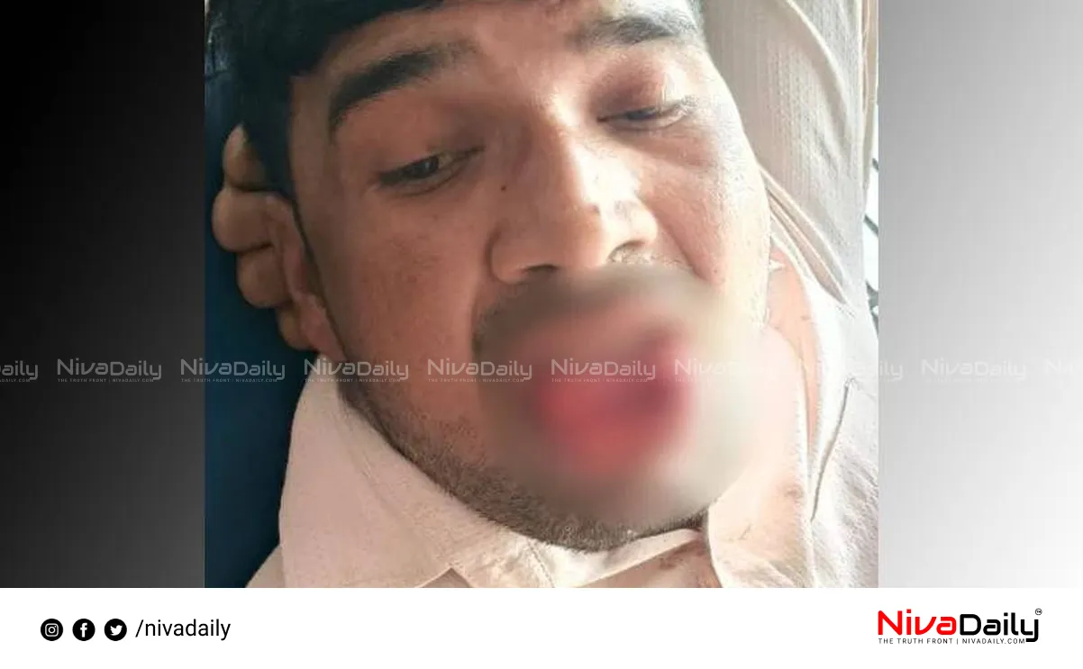 Kanpur tongue bite incident
