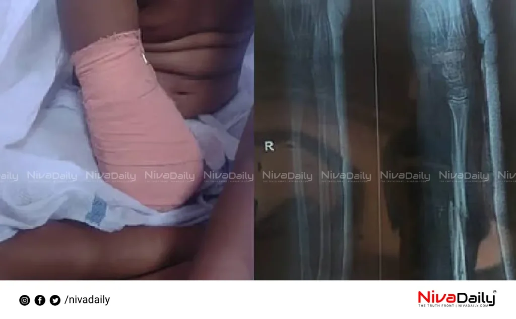 hand amputation case